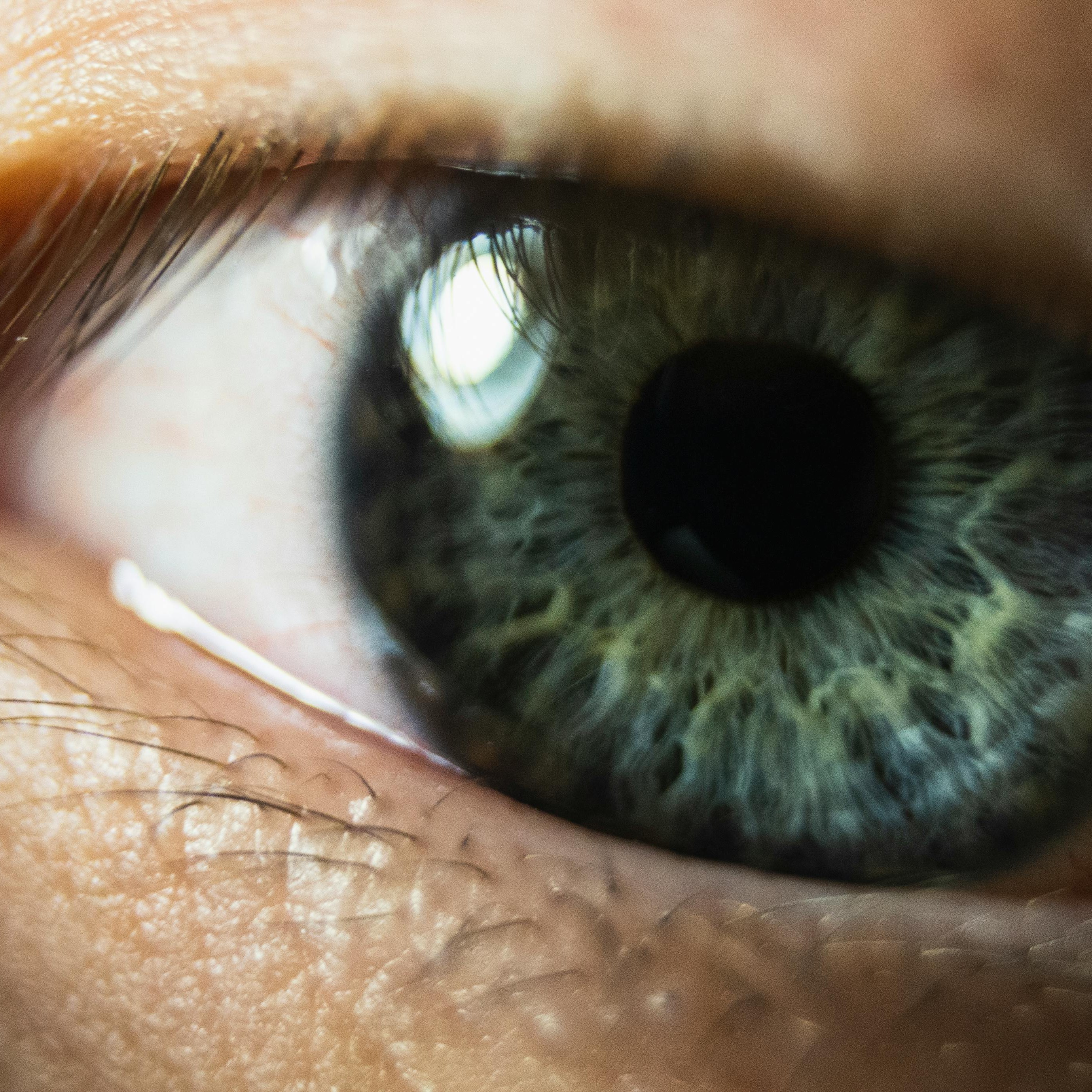 Vision Therapy